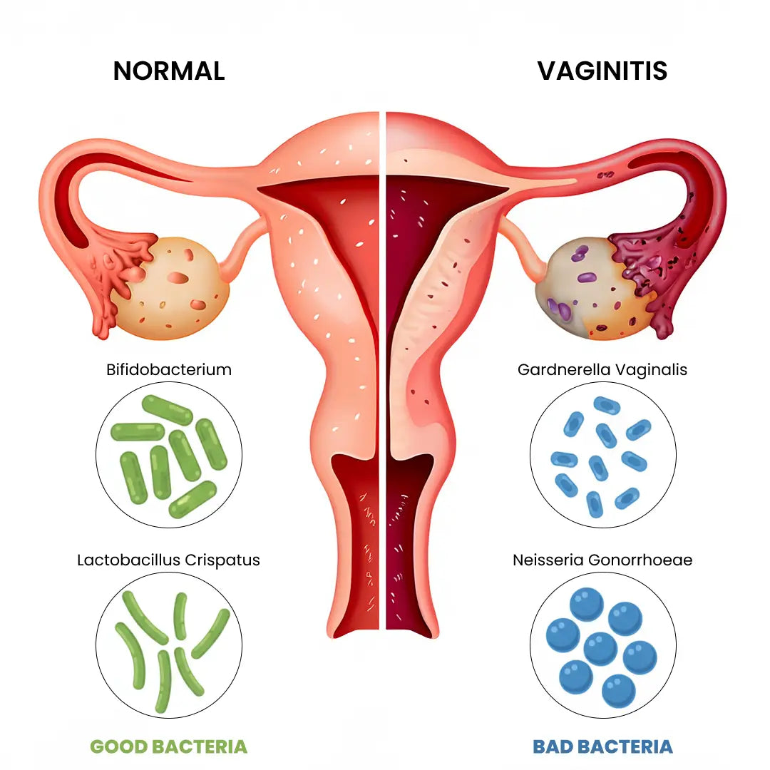 ๐๐๐ฒ ๐๐จ๐จ๐๐๐ฒ๐ ๐ญ๐จ ๐๐๐ ๐ข๐ง๐๐ฅ ๐๐๐จ๐ซ & ๐๐๐ฌ๐ญ๐จ๐ซ๐ ๐๐จ๐ฎ๐ซ ๐ฉ๐ - ๐๐๐ญ๐ฎ๐ซ๐๐ฅ๐ฅ๐ฒ-๐