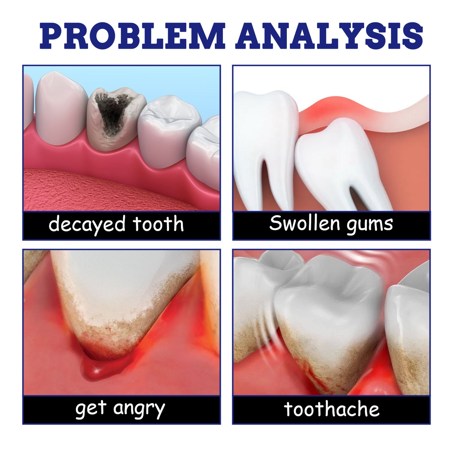 🦷 SEATLIKE TOOTHACHE RELIEF SPRAY|✨ SAY GOODBYE TO TOOTH PAIN AND HELLO TO A FRESHER SMILE-ASS1