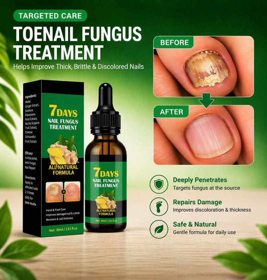 Say Goodbye to Nail Fungus & Damaged Nails-AFF
