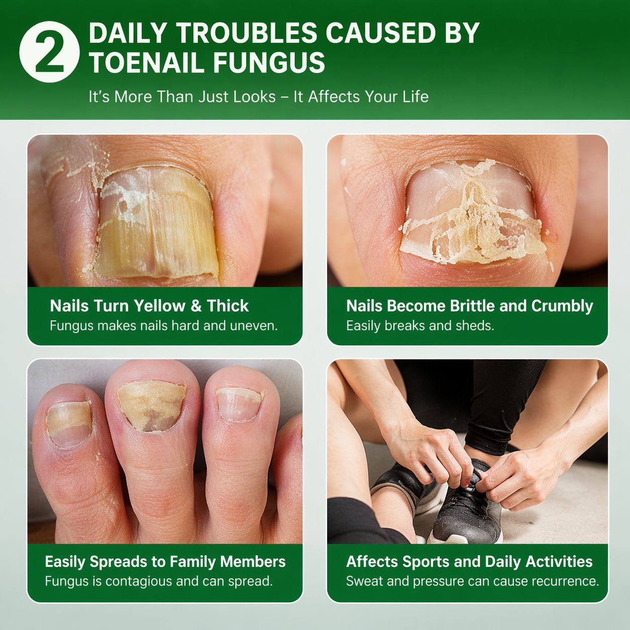 Say Goodbye to Nail Fungus & Damaged Nails-AFF