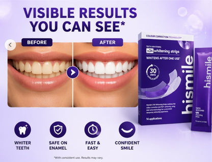 Teeth Whitening Strips – Visible Results in 7–30 Days, Easy & Travel-Friendly-AFF
